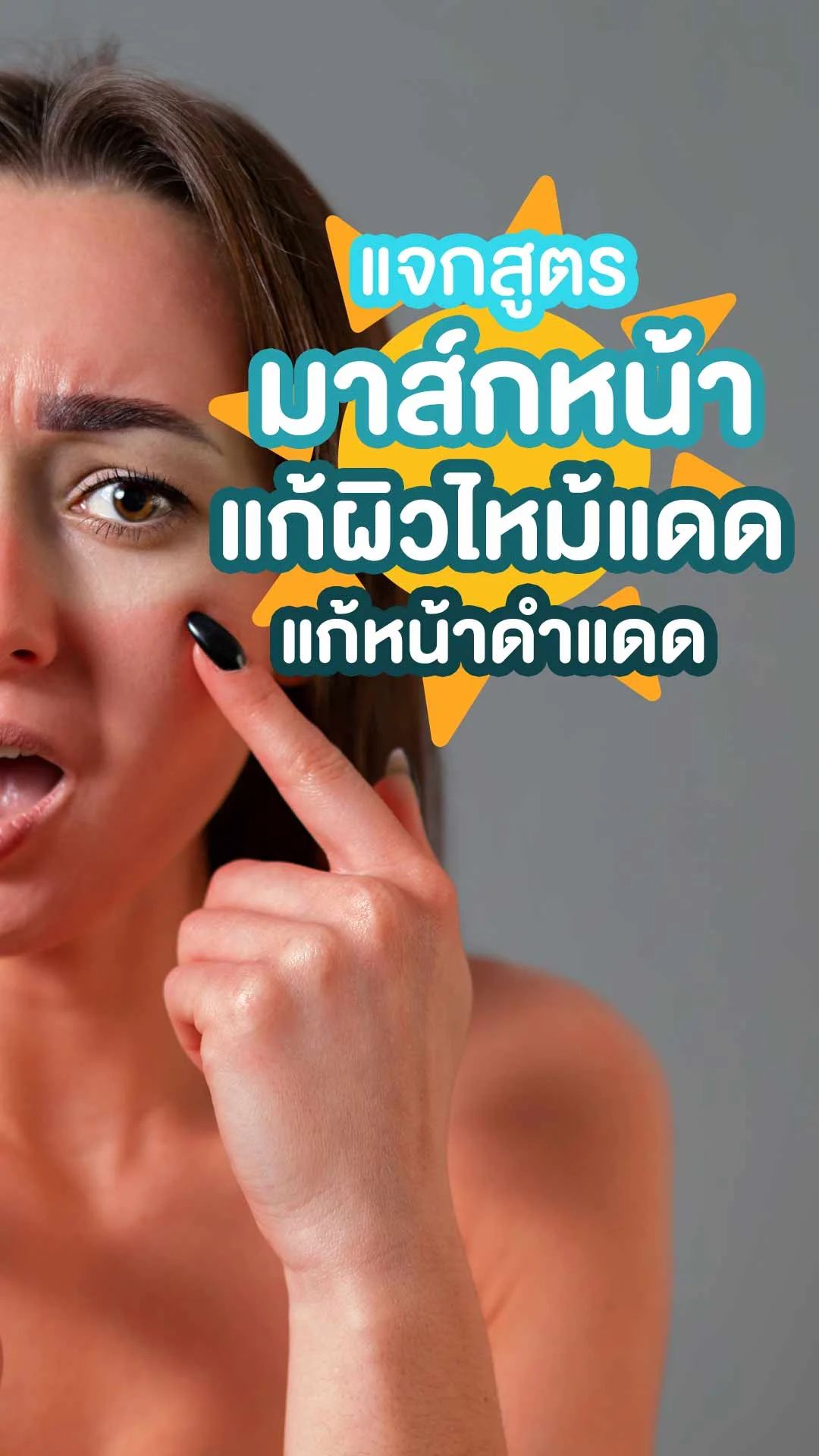6 สูตรมาส์กหน้า แก้ผิวไหม้แดด พร้อมส่วนลดปรึกษาแพทย์ผิวหนัง