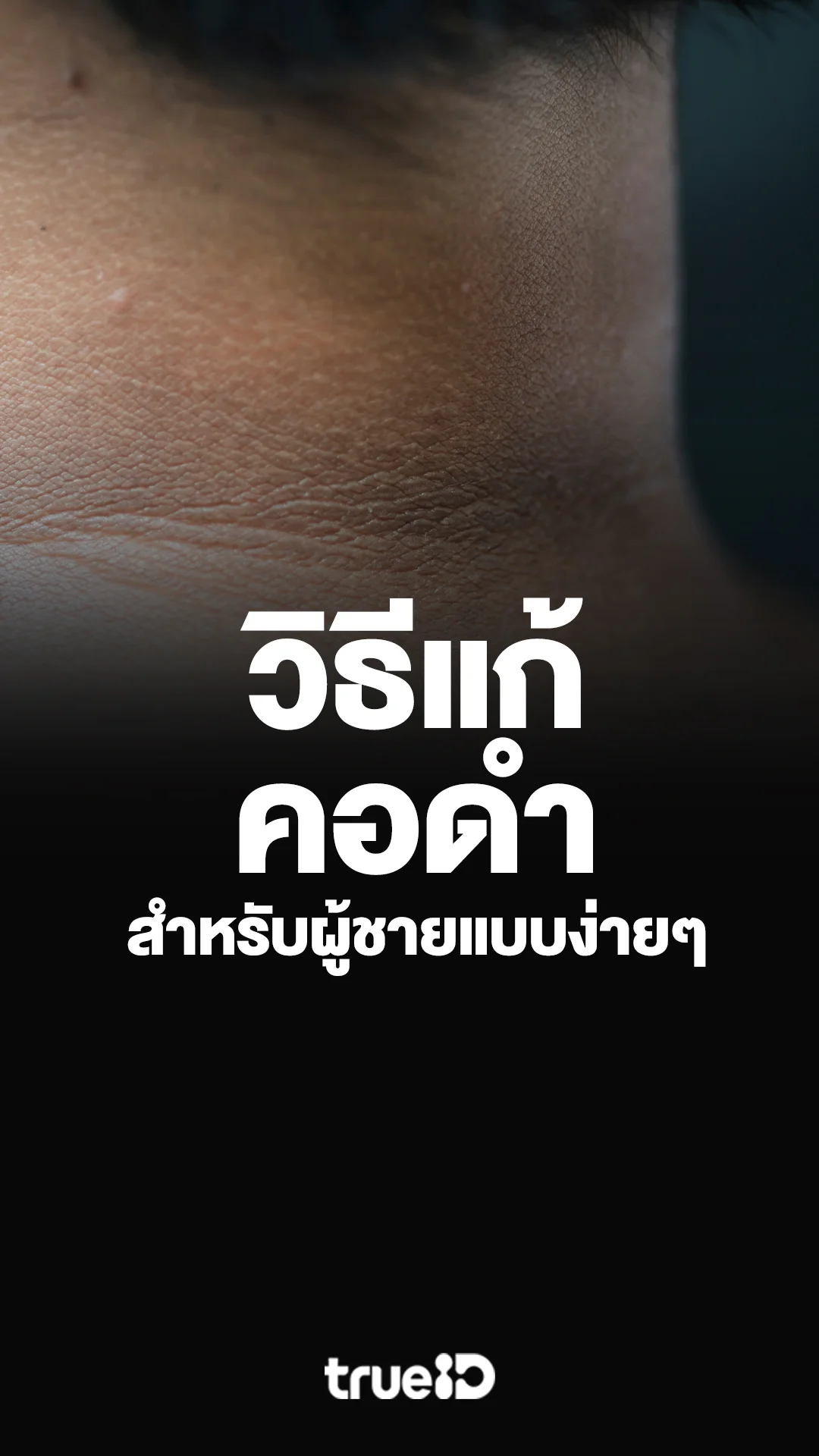 วิธีแก้คอดำสำหรับผู้ชายแบบง่ายๆ ด้วยตัวเอง