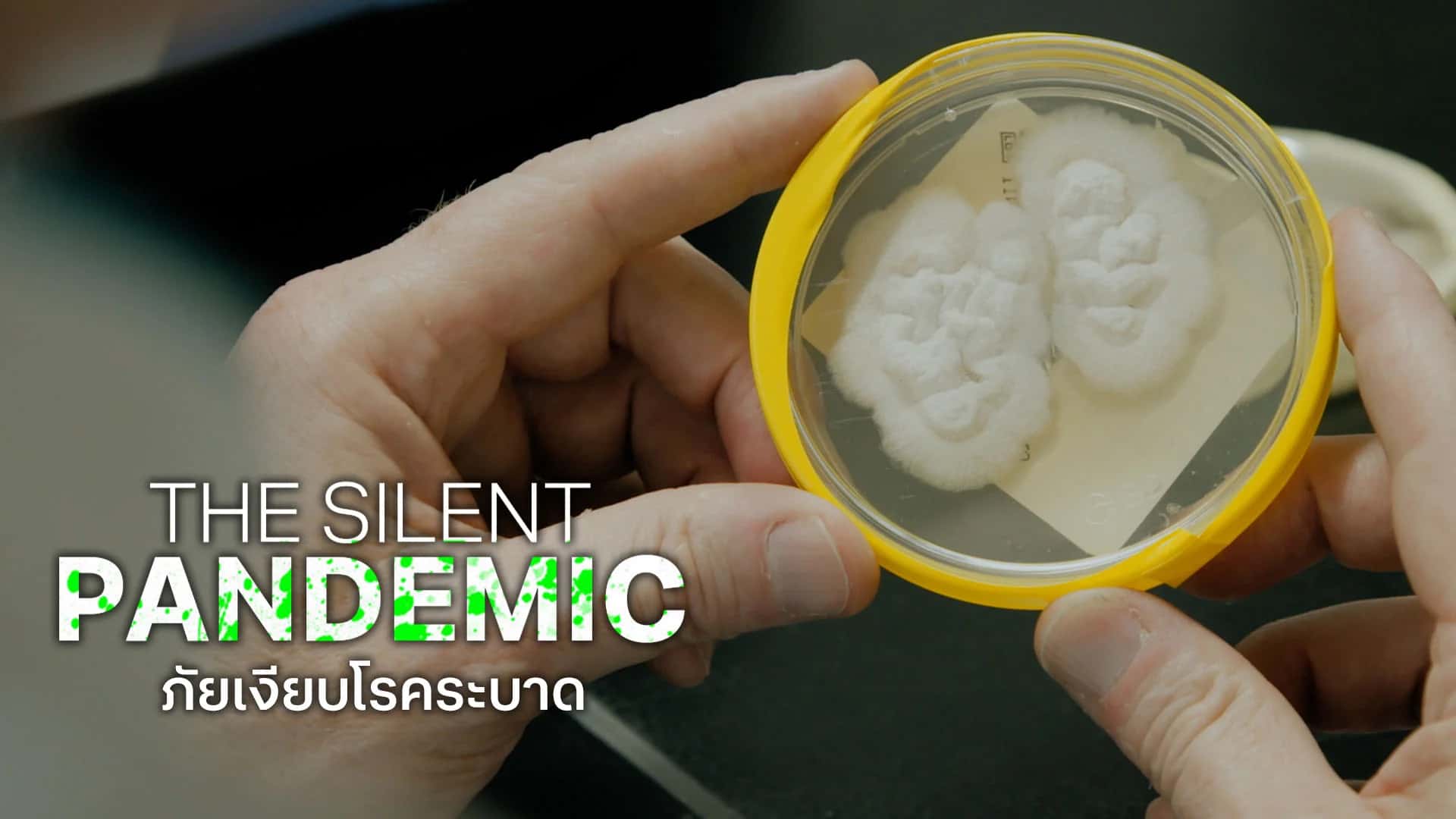 ภัยเงียบโรคระบาด